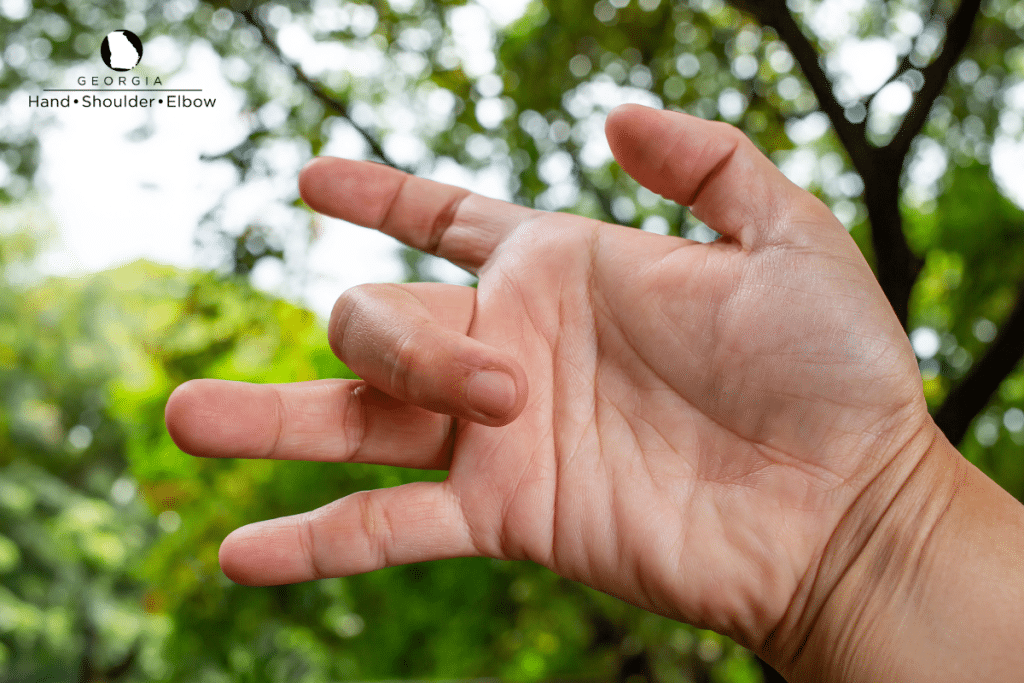 A person with trigger finger in Atlanta, Georgia.