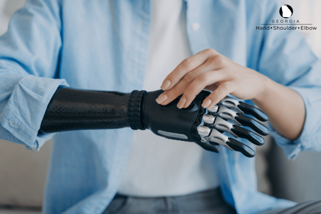 A woman touching her prosthetic arm to get used to it after an amputation in Georgia.