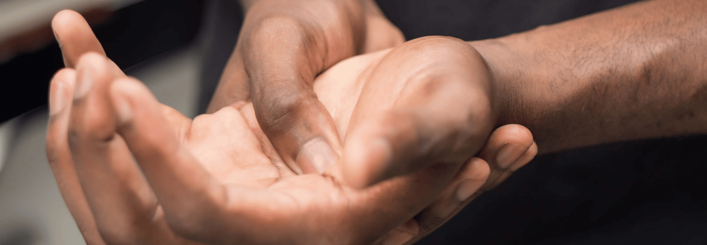 Dupuytren’s Contracture vs Trigger Finger Atlanta, GA